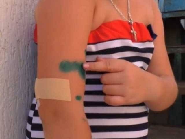 Под Луцком собака напала на 8-летнюю девочку: повреждены лицо и руки