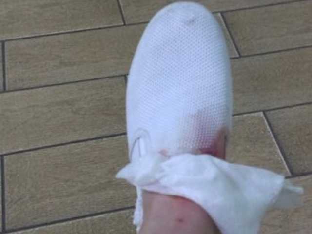 В Запорожье маршрутчик дверью рассек пассажирке ногу и не дал аптечку