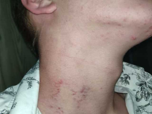 Во львовском ночном клубе избили гражданина Польши