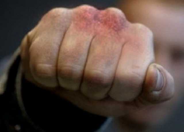 Бил по голове: серийным грабителем женщин в Киеве оказался экс-боец "Беркута"