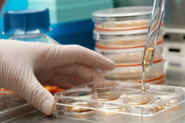 Впервые в истории! В Израиле мужчине вырастили новую ногу из жира