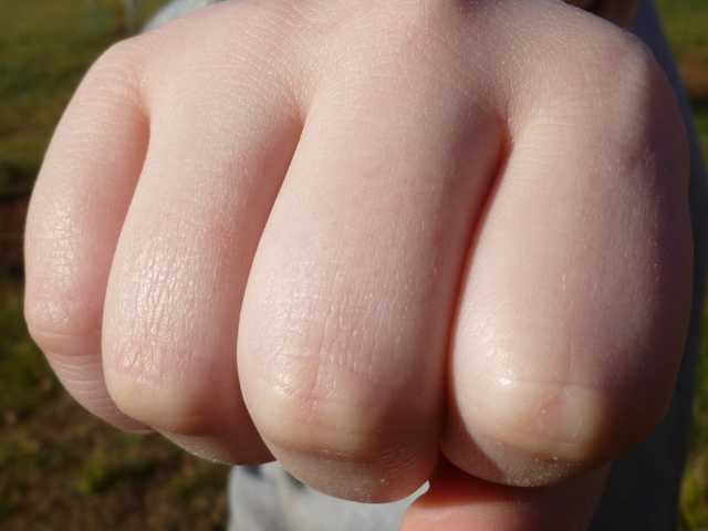 Подростки избили бездомного в Запорожье: волонтеры помогли несчастному