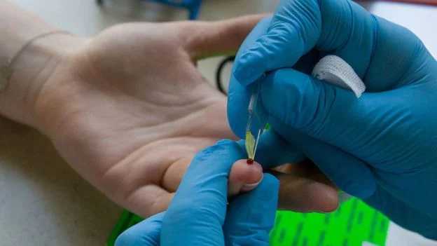 В Нидерландах ученые научились определять, кто умрет в ближайшие 5-10 лет