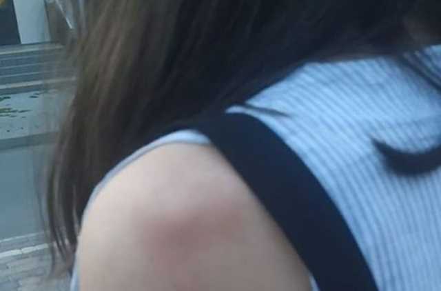 В Черновцах подростки массово издевались над школьницей