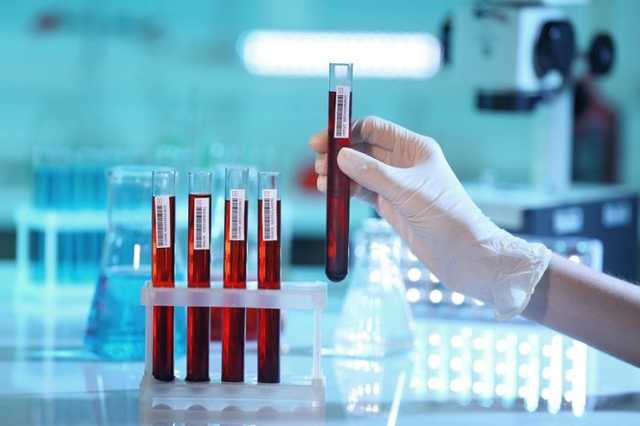 Анализ мочи и тест на беременность: опубликован список бесплатных исследований для украинцев