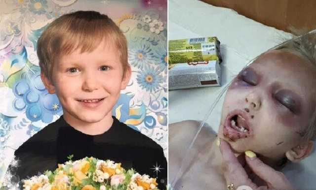 Колола иголкой и запрещала плакать: на Днепропетровщине мать зверски издевалась над ребенком