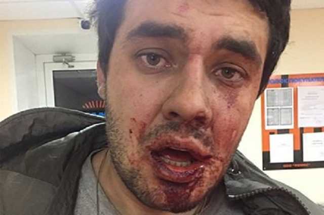 Депутату Путина порвали щеку за замечание: подробности