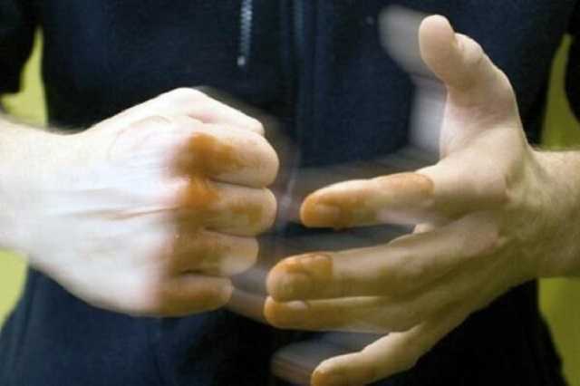 Стены залиты кровью: в общежитии Днепра пьяный студент устроил ЧП