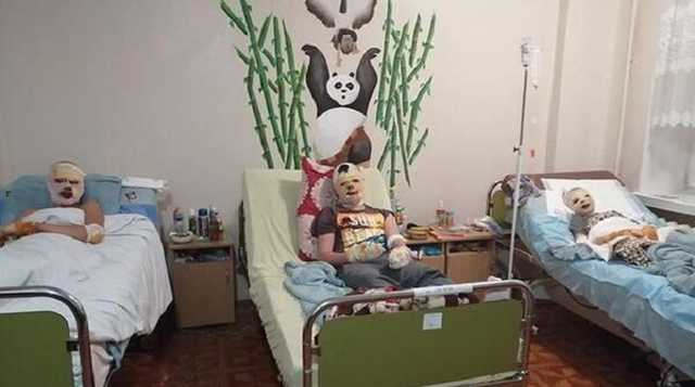 На Тернопольщине мошенники украли деньги на лечение обгоревших детей