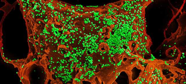 Коронавирус: в Китае мужчина умер после выздоровления