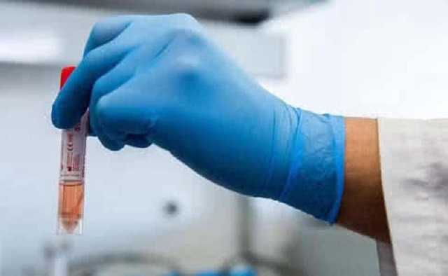 Врач-инфекционист признала, что больных COVID-19 гораздо больше, чем официально