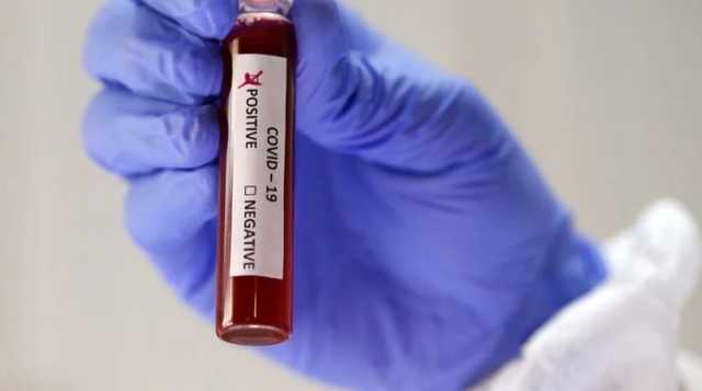 Чем грозит Украине низкая тестируемость на коронавирус — Доний