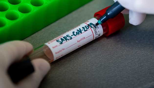 Людей с воспалением легких в Киеве начали тестировать на коронавирус, - Кличко