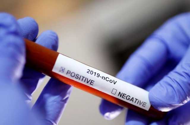 Коронавирус перехитрил медиков: названы новые симптомы заболевания