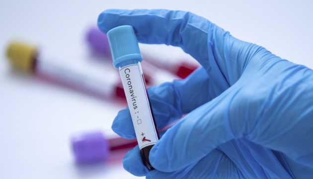 Стало известно об опасной особенности COVID-19: прячется и защищается