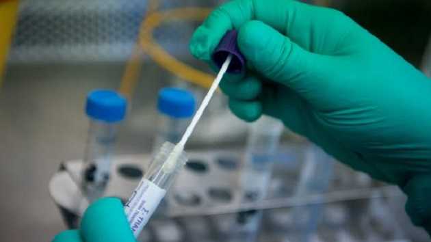 В Хмельницкой области обнаружили 11 новых случаев COVID-19