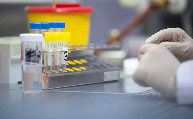 Степанов рассказал, в каких случаях придется платить за тестирование на Covid-19