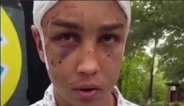 Хотели опустить: суд арестовал извергов, избивших до полусмерти подростка в Харькове