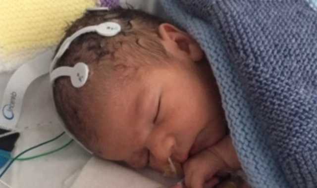 В Британии новорождённого начали лечить препаратом с марихуаной