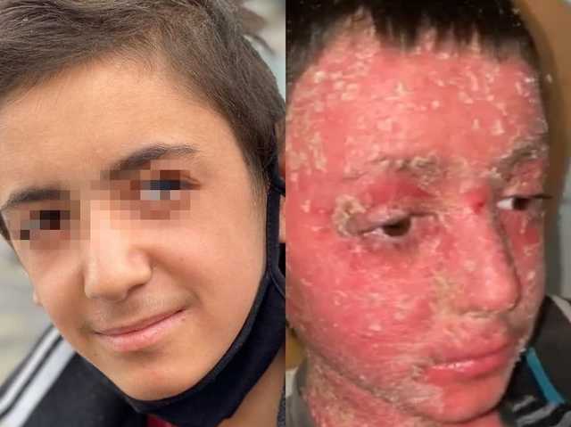 Дрожал от температуры и раздирал тело: на Закарпатье чудом спасли брошенного ребенка