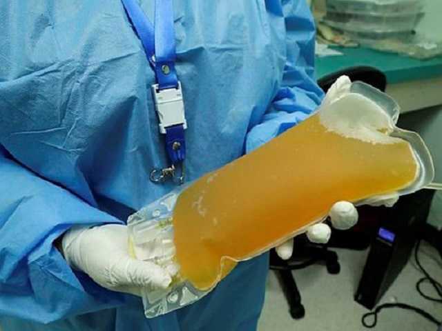 Поможет плазма: ученые выяснили надежный способ ускорить восстановление заболевших коронавирусом