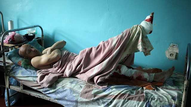 Ресурс ДНР рассказал, как боевиков лечат «в кредит»