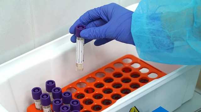 Плюс 841 за сутки: в Украине заразились коронавирусом 35 825 человек