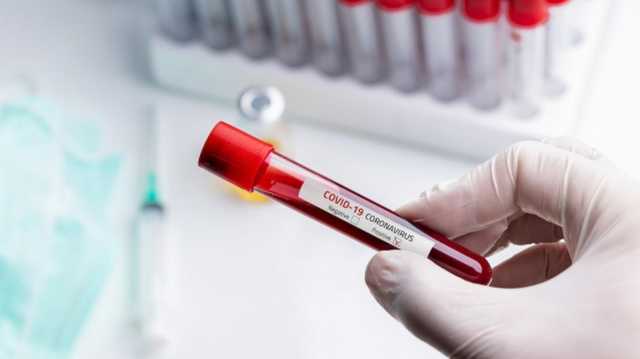 В Киеве еще у 115 человек за сутки подтвердили коронавирус