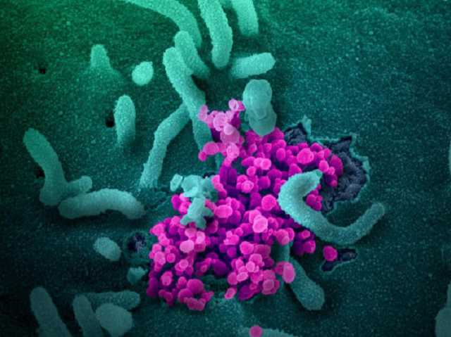 За сутки от коронавируса в Украине умерли 27 человек