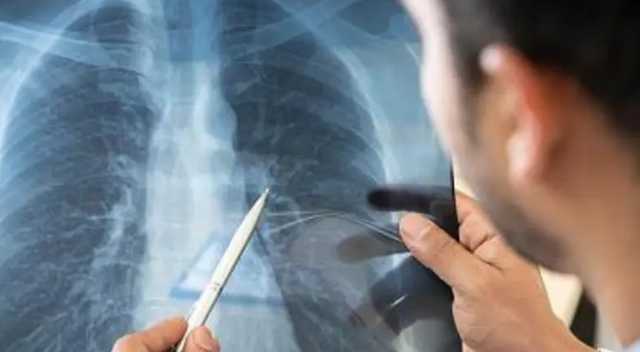 Врач пояснила, почему коронавирус у больных в Украине протекает легче