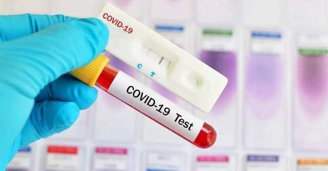 В Украине за сутки 612 случаев заражения коронавирусом