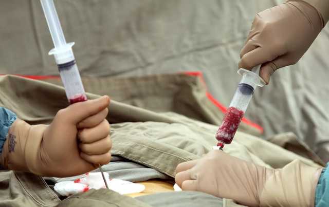 Государство будет полностью финансировать трансплантации костного мозга