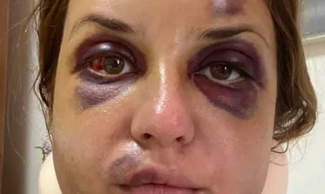 Избитая в поезде Мариуполь – Киев рассказала о проблемах с психикой сына