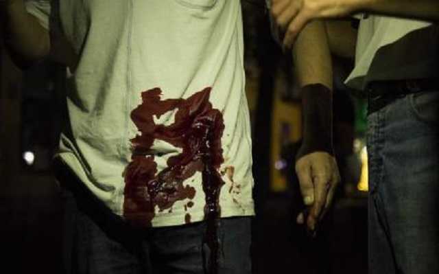 В Бресте каратели Лукашенко стреляли на поражение боевыми патронами. Их избили арматурой