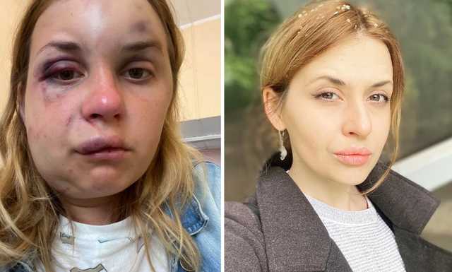 Предлагали 30 тысяч за молчание, – телеведущая Луговая об избиении в поезде