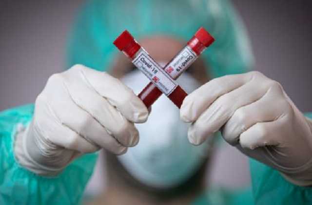 В Украине коронавирус за сутки убил десятки людей