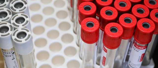 18-летний сын харьковской чиновницы продал лабцентрам материалы на 5 миллионов гривен