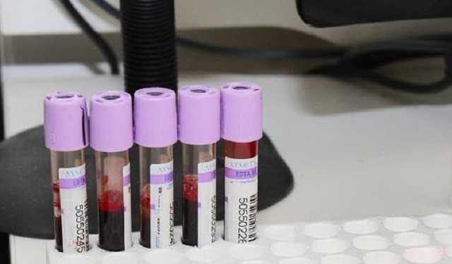 Коронавирус в Харьковской области: количество больных стремительно приближается к 11 тысячам