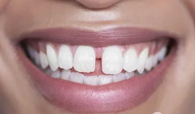 В TikTok появился новый опасный челлендж