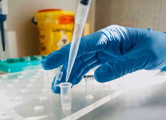 Вже понад 900 тисяч людей у світі померли від коронавірусу