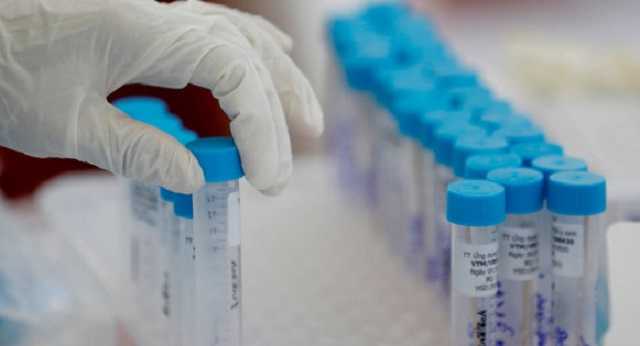 В Украине – 3,5 тысячи новых больных COVID-19