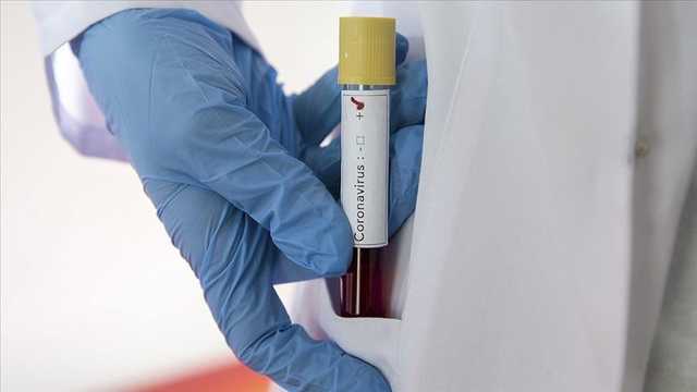 У світі вже понад мільйон людей померли від COVID-19