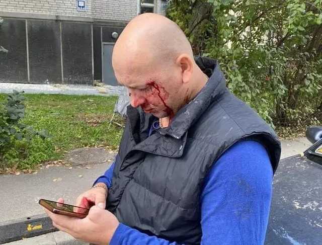 Избиение ветерана АТО в Киеве: Одному из нападавших сообщили о подозрении