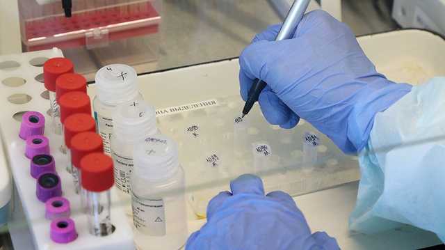 Ученые: Уровень антител у переболевших COVID-19 быстро падает