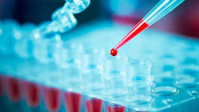 В Украине тесты на Covid-19 могут показывать лживые результаты: эксперты раскрыли детали