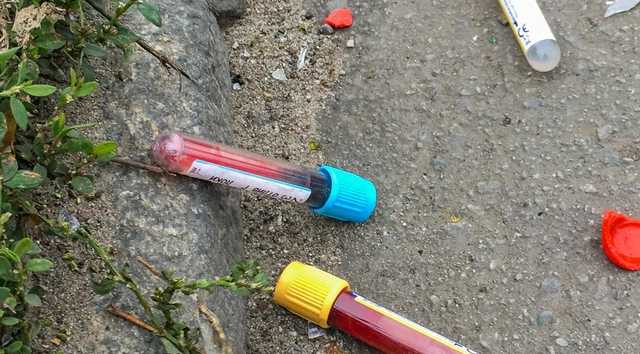 В Днепре на проезжей части валяются пробирки с анализами, подписанные фамилиями пациентов