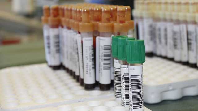 Санврач Ляшко назвал цену для украинцев на вакцину от коронавируса