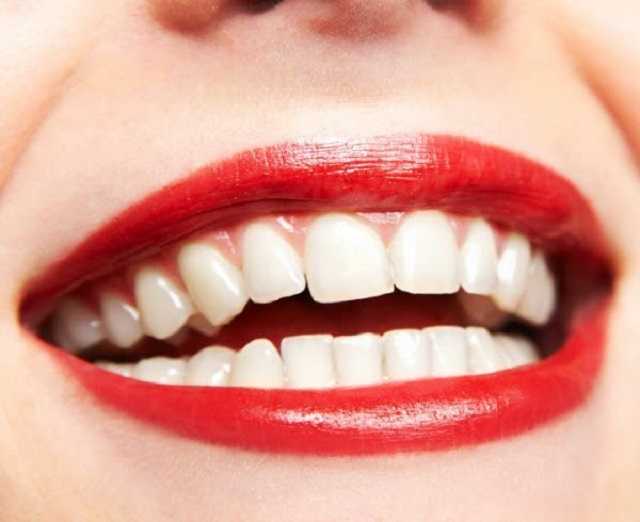 Коронавірус може призвести до проблем з яснами та випадіння зубів, — ЗМІ