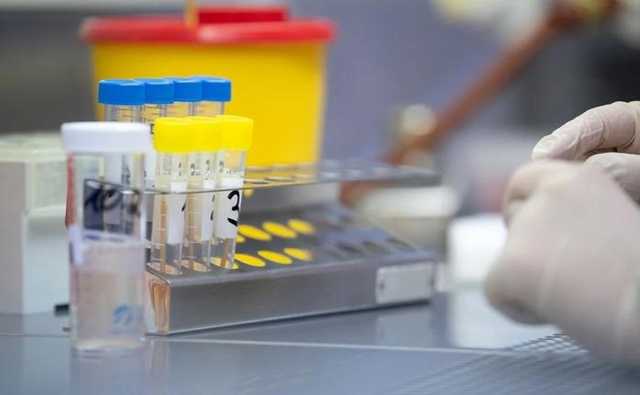 В Украине разработали уникальный сверхчувствительный "антигенный" тест на COVID-19