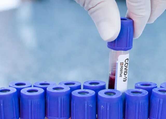 Степанов заявил о позитивной COVID-19 статистике в Украине